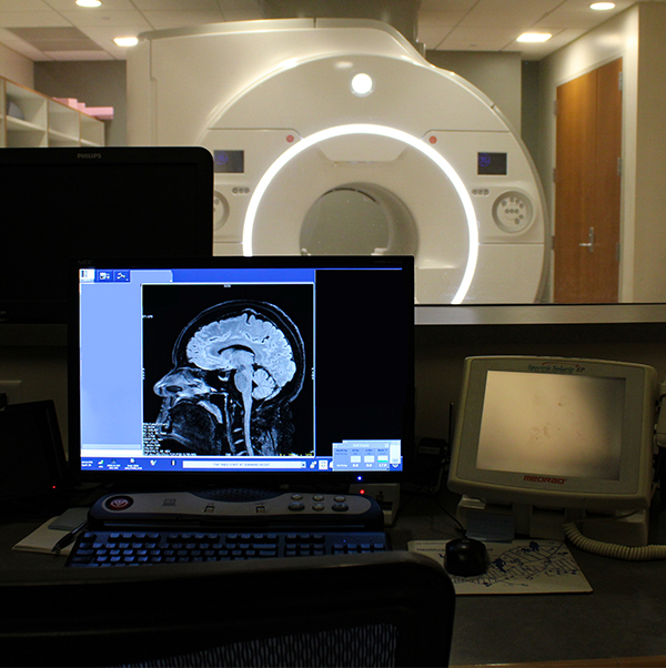 A computer monitor displays a brain scan from an MRI machine