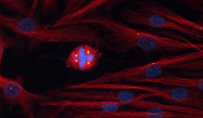 dividing cells and chromosomes under a microscope