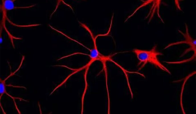 Microscopic view of astrocytes