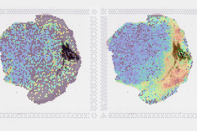 imaging of variable radiation dosage and variable tissue response