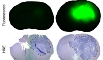 Near-infrared fluorescence and H&E counterstaining images used in bio-panning process to identify antibodies for an aggressive brain cancer called glioblastoma