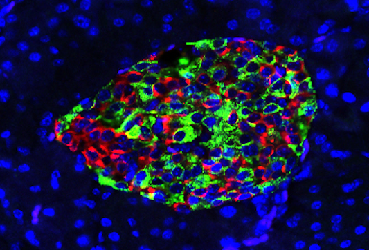 Beta cells in imaging