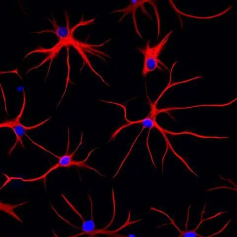 Microscopic view of astrocytes