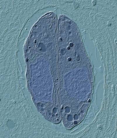 Microscopic image of parasite Toxoplasma gondii