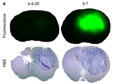 Near-infrared fluorescence and H&E counterstaining images used in bio-panning process to identify antibodies for an aggressive brain cancer called glioblastoma