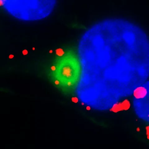 A neural stem cell in a dish